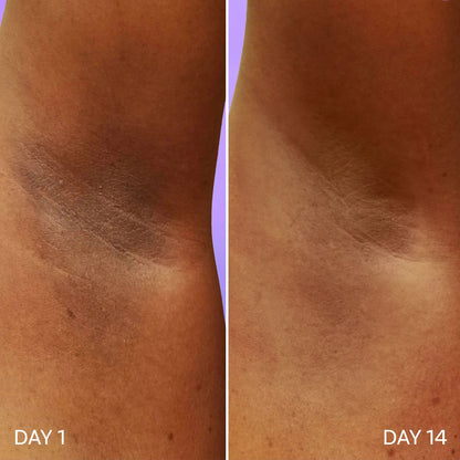 Under Arm Roll On (40 ml, Pack of 2)